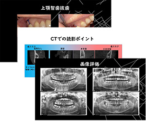 セミナーで使用したレジュメ