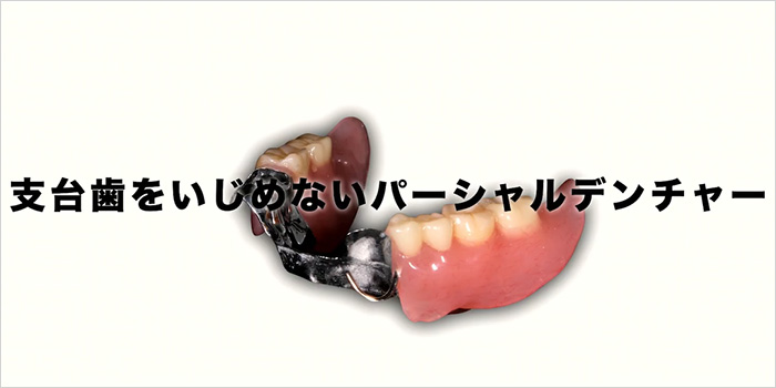 理想的なパーシャルデンチャーを実現するヒントが、ここにあります