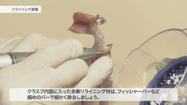 （実演）臨床におけるリライニングの手順