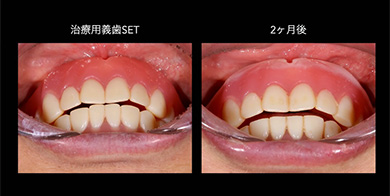 デジタルデンチャーの概要を理解しやすい「約30分」の講義です