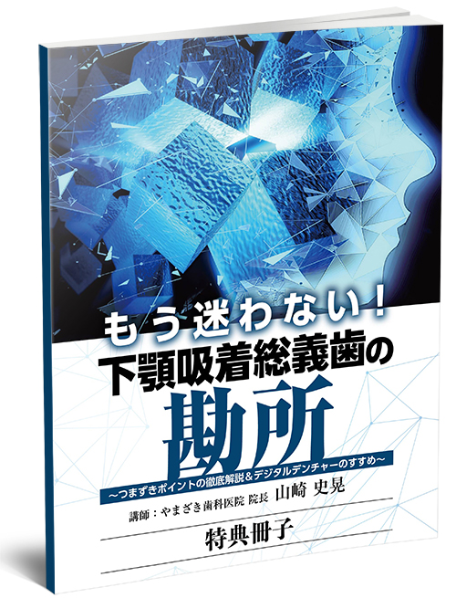 株式会社 医療情報研究所 | もう迷わない！ 下顎吸着総義歯の勘所 